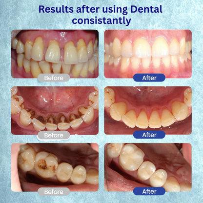 Dental Cavity Serum